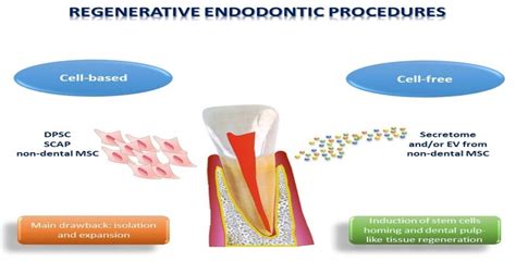 Regenerative Procedures .